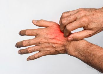 Skin Diseases